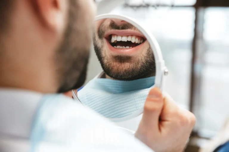 Tooth Colored Fillings