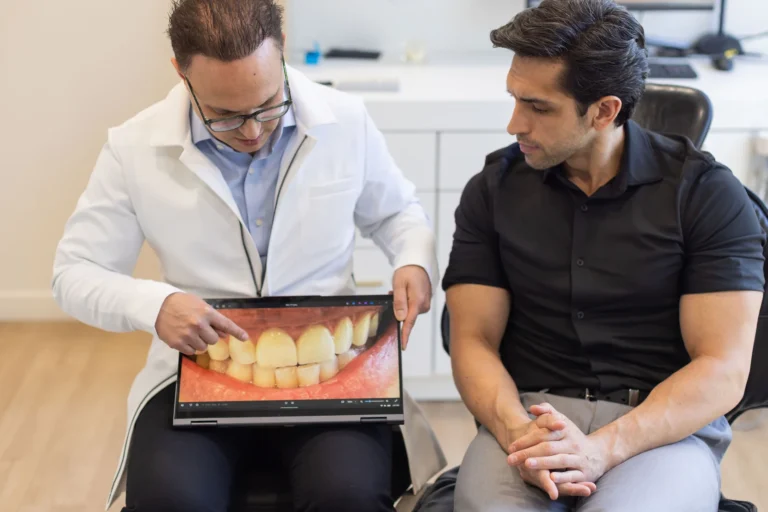 Dental Veneers