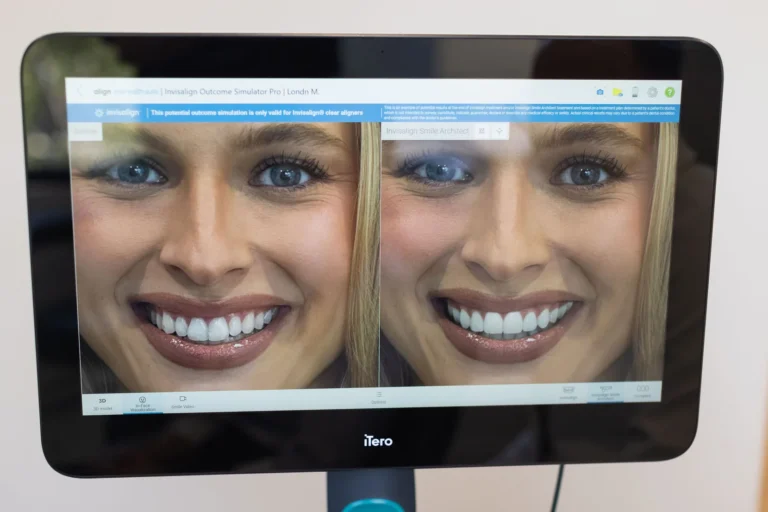 Smile Design